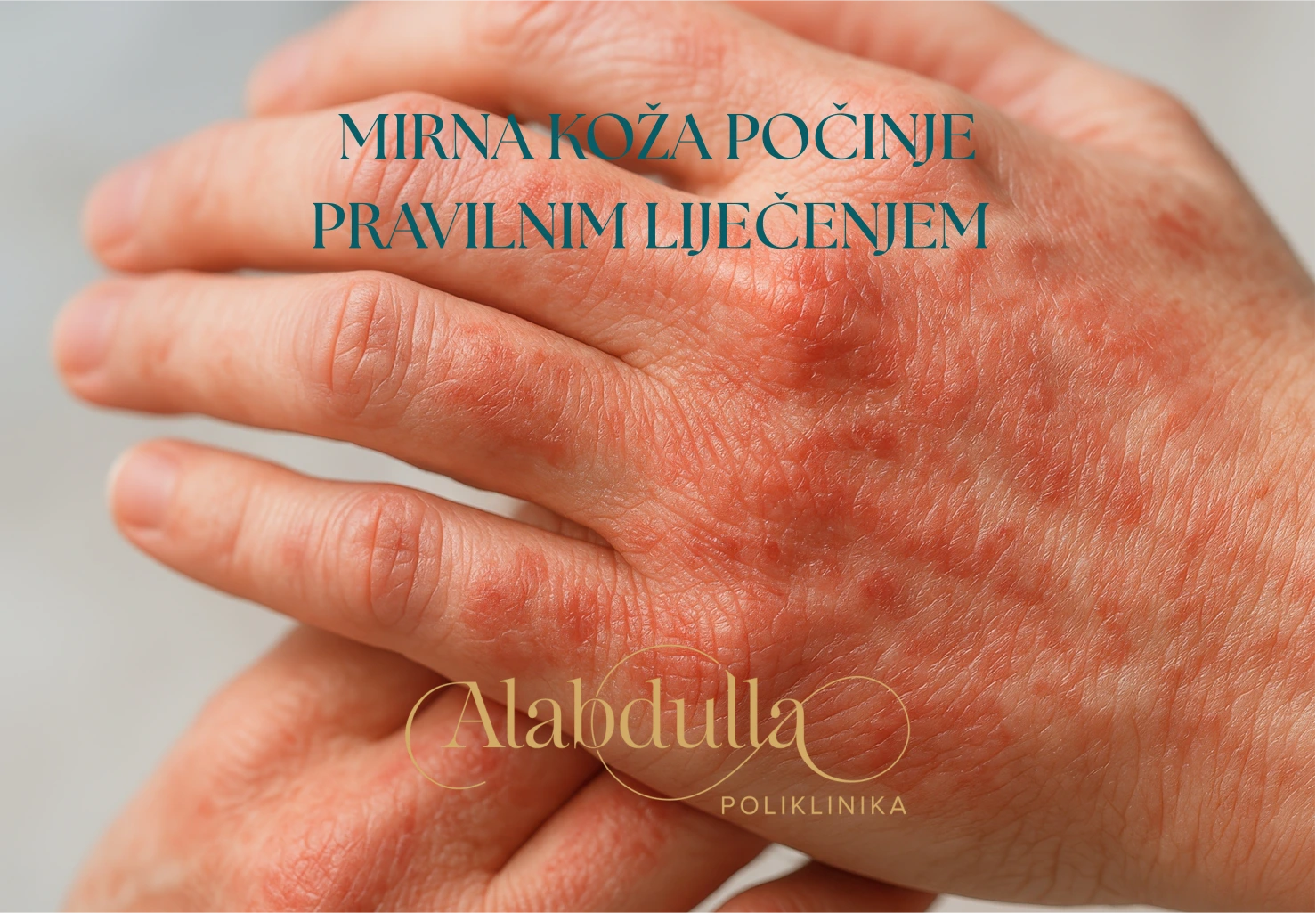 mirna-koza-lijecenje dermatologija lijecenje