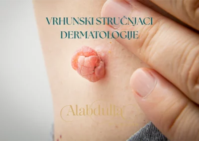 dermatolgija vrhunski strucnjaci
